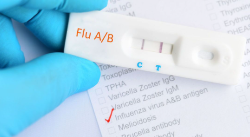 Fondo y tratamiento de la prueba de diagnóstico rápido de influenza