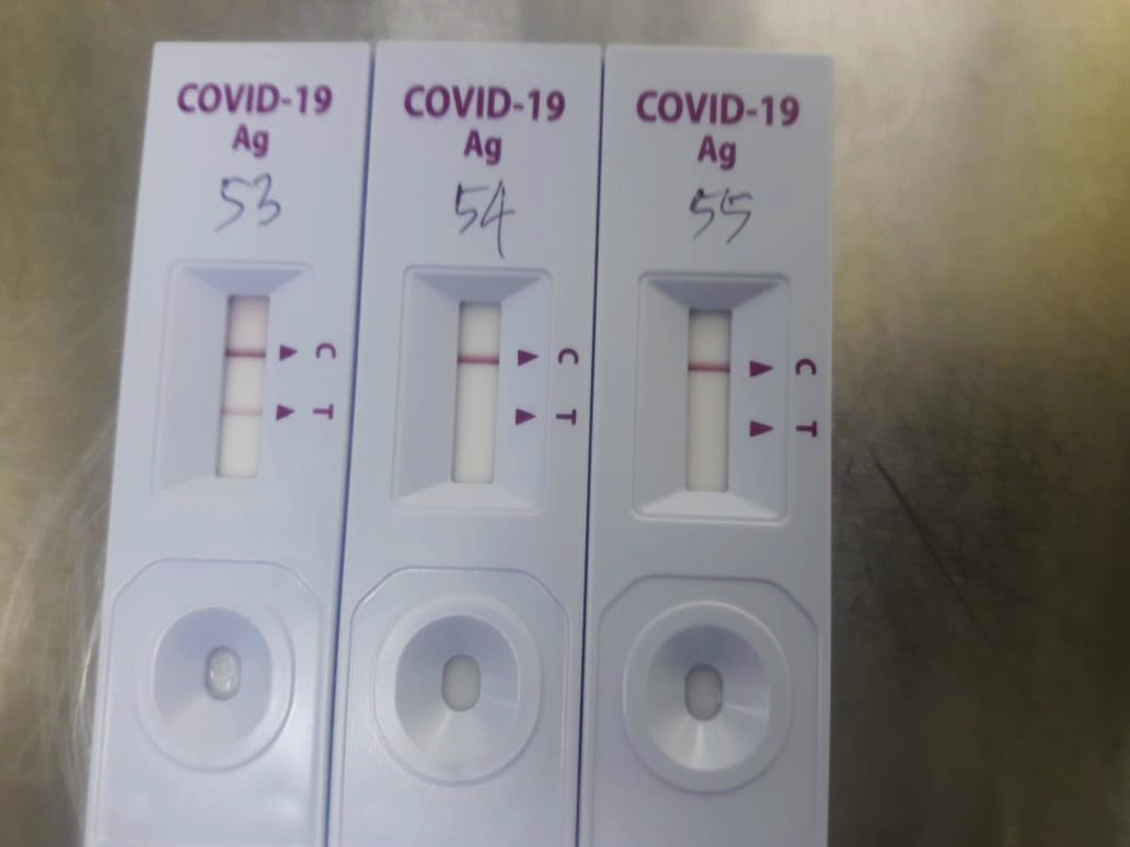 PCR vs Prueba de antígeno: ¿Qué prueba Covid-19 es adecuada para mí?